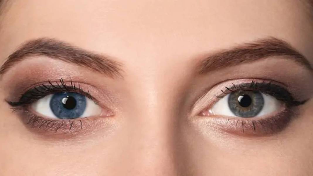 Bu fiziksel özelliklere sahipseniz şanslı azınlıktasınız! Doğuştan geliyor ve nadir bulunuyor 1